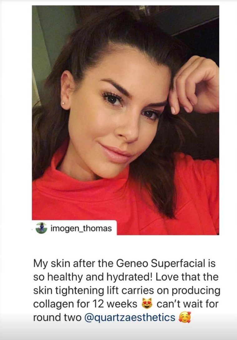 Imogen Thomas posting about her Geneo Superfacial with Quartz Aesthetics