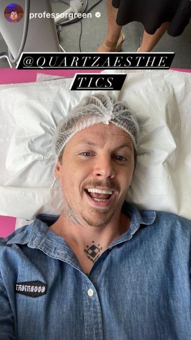 Professor Green posting about his treatment with Quartz Aesthetics